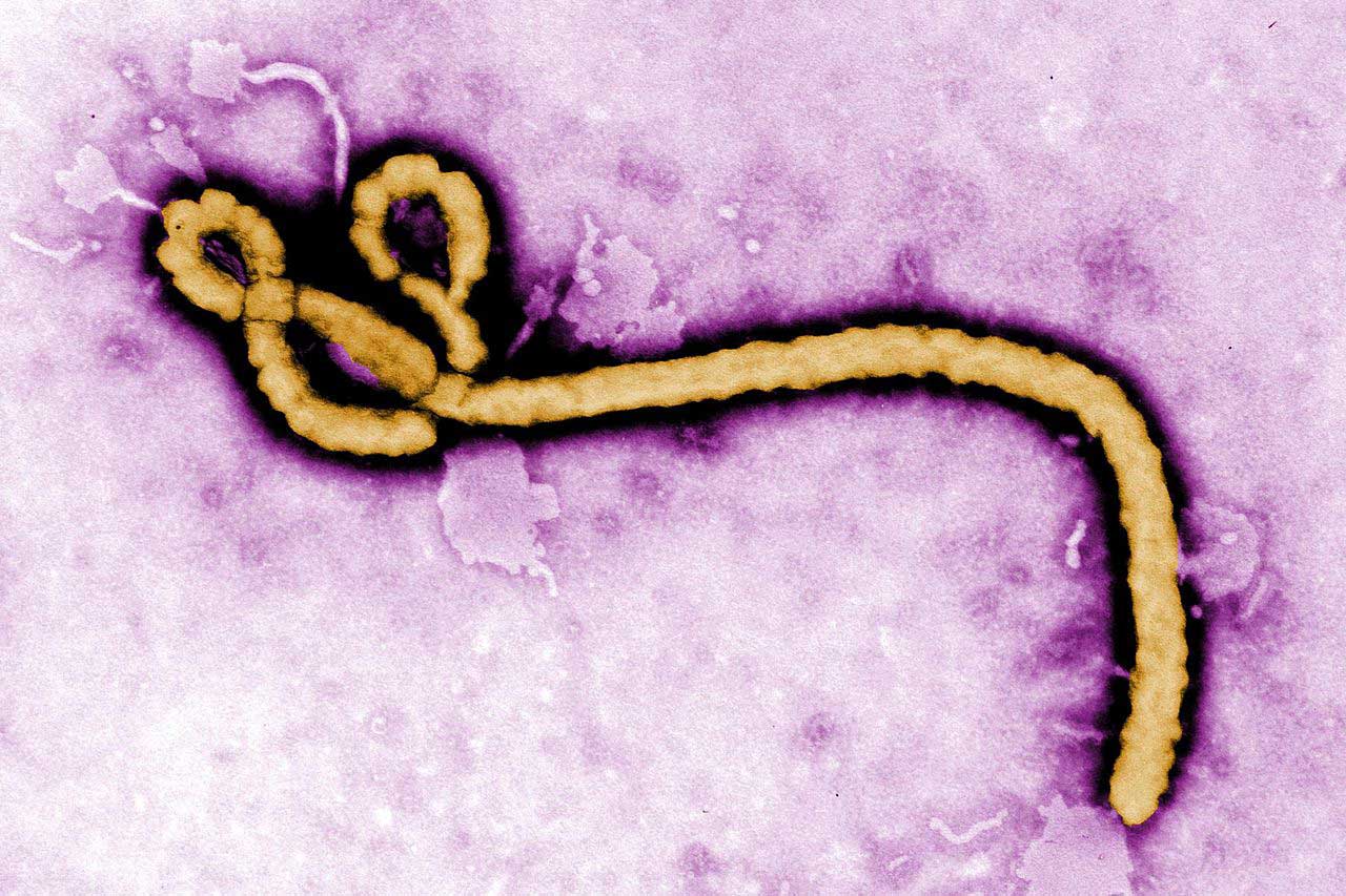 The Ebola virus. Credit: CDC Global.