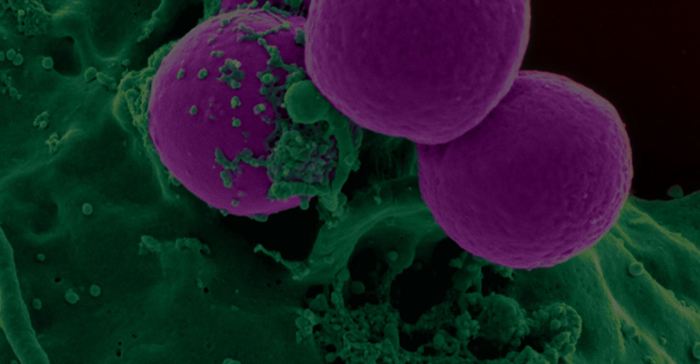 Human_neutrophil_ingesting_MRSA