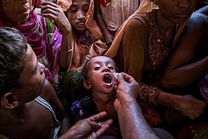 A Rohingya child receives the oral cholera vaccine at Shafullarkata refugee camp in Cox’s Bazar, Bangladesh. In 2017, Gavi funded one of the largest cholera vaccination campaigns in history to protect nearly a million people against the disease in camps and surrounding areas. Working on the principle that no child should be denied the right to good health, including access to life-saving vaccines, the Alliance continues to support routine immunisation at the camps.