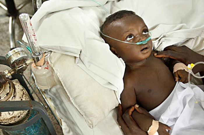 Isiah Anane, just nine-months-old, breathes oxygen to help her laboured breathing.   Pneumonia with diarrhoea is the leading cause of child death both in Ghana and across the world.