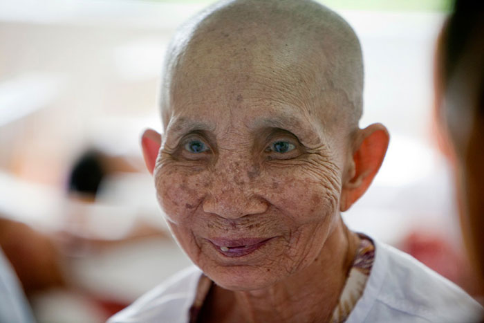 Cervical cancer patient waits for next round of treatment at the Ho Chi Minh City Oncology Hospital in Vietnam, December 2010. 