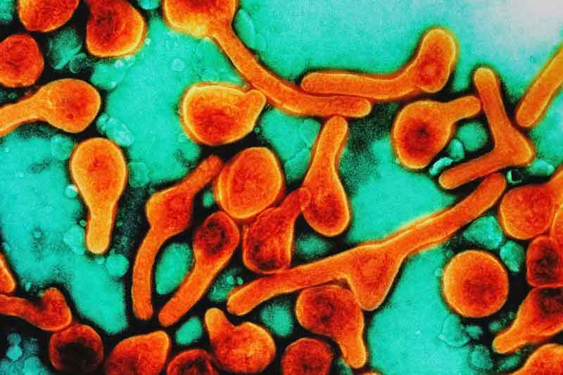 Marburg virus particles. Credit: NIAID/Unsplash