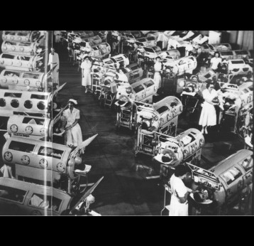 Iron Lungs: Polio patients at a medial ward.