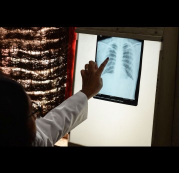 BCG has been used all over the world to protect against the development of TB. Noah Seelam/AFP via Getty Images