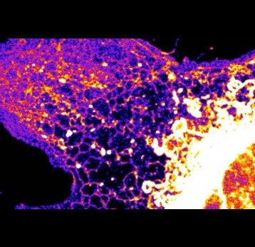 Fibroblast cells are important for healing wounds. Copyright: Leonel Malacrida, (CZI Imaging Scientist at Institut Pasteur de Montevideo-University of the Republic of Uruguay)