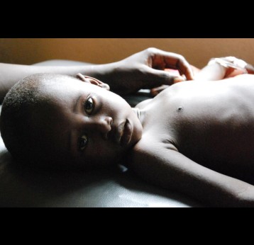  Abdul Kamara of Sierra Leone was threatened by severe diarrhoea, but he received rehydration treatment. Every year, 3 million children and adolescents die from infectious diseases study indicates. Credit: Doune Porter / GAVI, (CC BY-NC-ND 2.0)