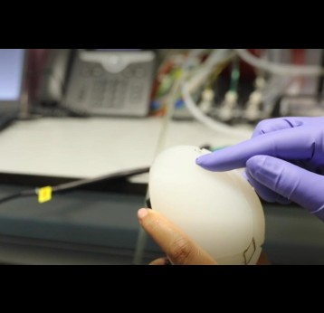 An obstetrician performs a mock vaginal examination on a fetal skull model in the lab using the smart glove, worn under a surgical glove. Credit: Wellcome/EPSRC Centre for Interventional and Surgical Sciences (WEISS)