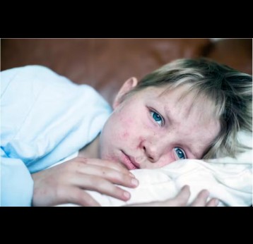 Les jeunes enfants, les femmes enceintes et les personnes immunodéprimées sont parmi les plus vulnérables à la rougeole. (CHBD/E+ via Getty Images)