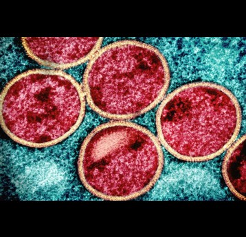 Mpox Virus Colorized transmission electron micrograph of immature mpox virus particles (red with tan viral envelope) found within an infected VERO E6 cell (teal), cultured in the laboratory. Image captured at the NIAID Integrated Research Facility (IRF) in Fort Detrick, Maryland. 