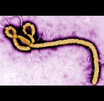 Le virus Ebola. Crédit : CDC