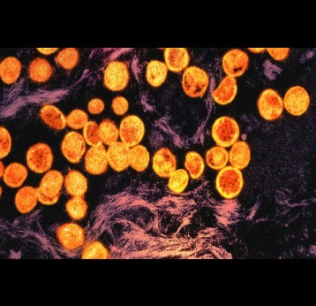 Une micrographie de particules du virus mpox (or et orange) à l’intérieur d’une cellule infectée (violet). Crédit : National Institute of Allergy and Infectious Diseases (NIAID)