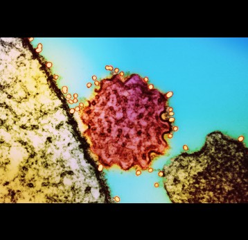 Nipah virus particle. Credit: National Institute of Allergy and Infectious Diseases