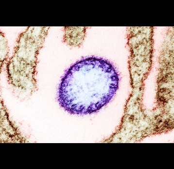 Colorised transmission electron micrograph of a mature extracellular Nipah Virus particle (purple) near the periphery of an infected VERO cell (brown). Image captured and color-enhanced at the NIAID Integrated Research Facility in Fort Detrick, Maryland. Credit: NIAID (CC by 2.0)
