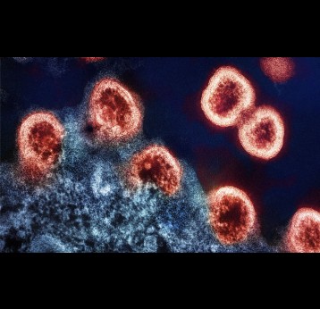 Virus particles. Credit: National Institute of Allergy and Infectious Diseases