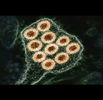 Colorised transmission electron micrograph of rabies virus particles. Credit: NIAID