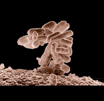 Low-temperature electron micrograph of a cluster of E. coli bacteria, magnified 10,000 times. Each individual bacterium is oblong shaped. Credit: Eric Erbe, digital colorisation by Christopher Pooley, both of USDA, ARS, EMU.