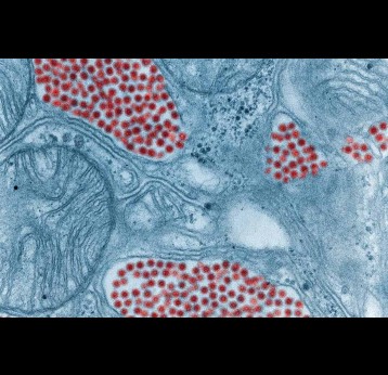 Colourised transmission electron micrograph (TEM) depicting a salivary gland that had been extracted from a mosquito, infected by the Eastern equine encephalitis (EEE) virus. Credit: Fred Murphy and Sylvia Whitfield, CDC Public Library
