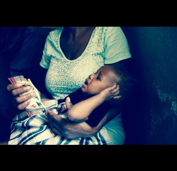 Globally, nearly half of the deaths of children under five years are linked to malnutrition. Wikimedia Commons
