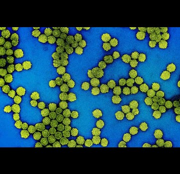 Colorised electron micrograph of HPV virus particles (yellow) harvested and purified from cell culture supernatant. Credit: NIAID