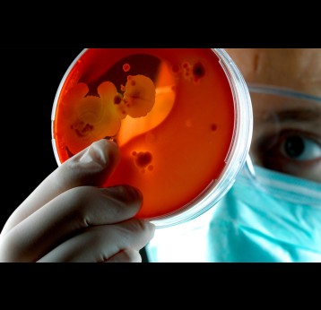 Scientist examining petri dish of bacteria. Credit: E+ via Getty Images
