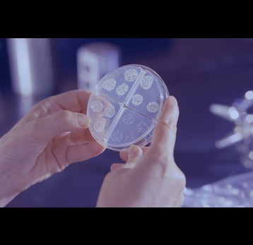 A Mycobacterium tuberculosis drug susceptibility test. Credit: CDC/Unsplash