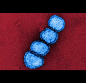 Colorised transmission electron micrograph of influenza A/H1N1 virus particles (blue). Credit: NIAID/NIH