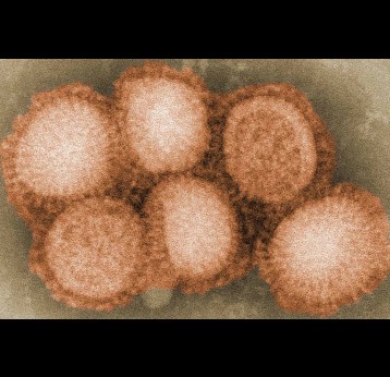Flu Cells visible under microscope. Credit: Cybercobra at English Wikipedia (CC BY-SA 3.0)