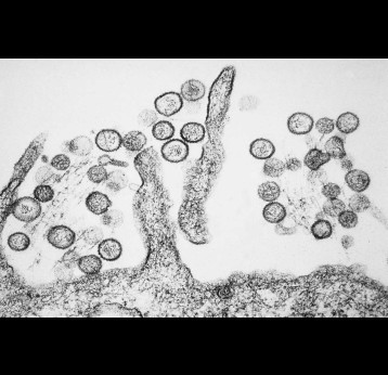 A transmission electron micrograph of Sin Nombre virus. Credit: CDC/Cynthia Goldsmith