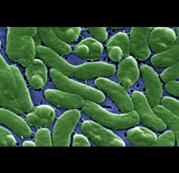 False color scanning electron micrograph of Vibrio vulnificus bacteria. Credit: CDC/James Gathany