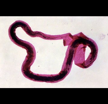 A filarial worm, one of the causative agents of Elephantiasis (lymphatic filariasis). Researchers in Tanzania say eliminating the disease reduced susceptibility to HIV infection. Copyright: CDC