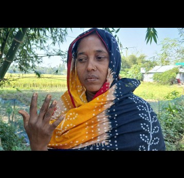 Fatema, a 40 year-old woman in the Rangpur district, showing her infected hands. Credit: Mohammad Al Amin