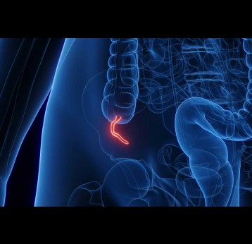 Most people get acquainted with their appendix when it’s inflamed and about to rupture. Sebastian Kaulitzki/Science Photo Library via Getty Images