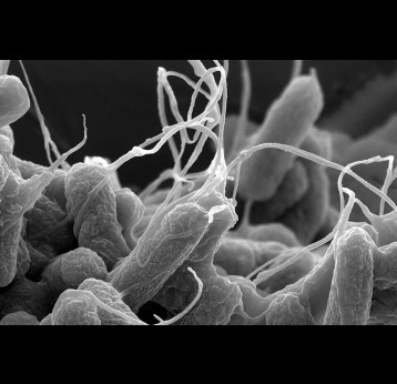 Physics-based simulations can help identify which peptide antibiotics can kill a bacteria like E. coli, pictured here using electron microscopy. (Nurgul D / Wikimedia Commons), CC BY-SA