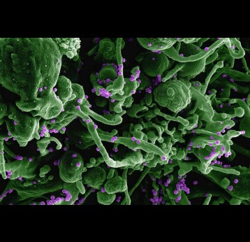 Micrograph of Lassa virus budding off a cell. Photo by National Institute of Allergy and Infectious Diseases on Unsplash