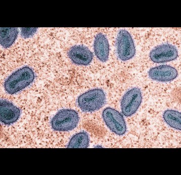 Mpox virus colorised transmission electron micrograph of mpox virus particles (purple and teal) found within an infected cell (brown), cultured in the laboratory. Photo by National Institute of Allergy and Infectious Diseases on Unsplash