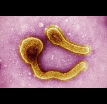 Marburg virus particles colourised. Photo by National Institute of Allergy and Infectious Diseases on Unsplash