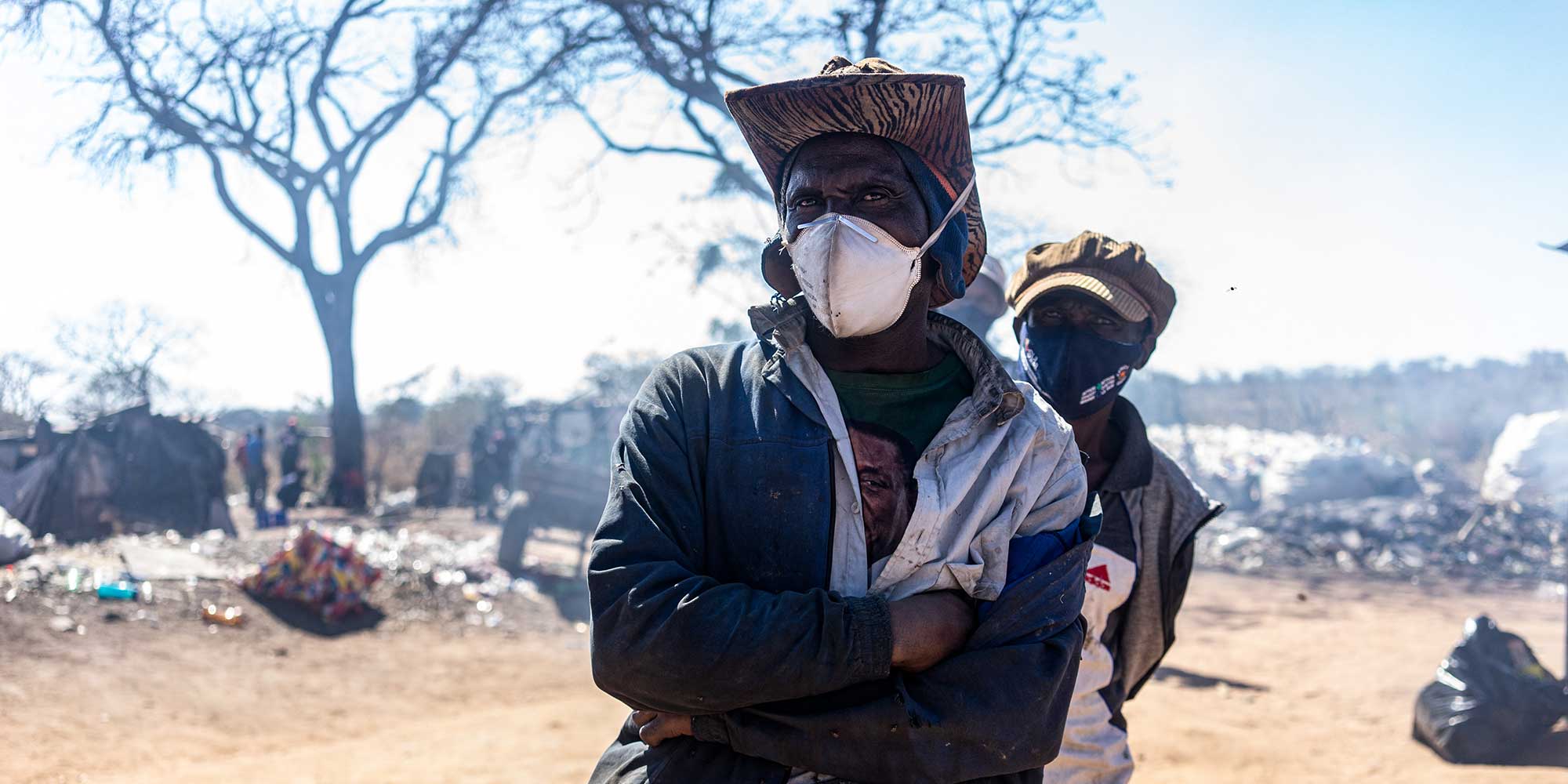 Waste picker Khumbulani Tshuma, 44, impatiently waits his turn to have his first dose of COVID-19 vaccine at Richmond Landfill Site, popularly known as Ngozi Mine, in Zimbabwe’s second city of Bulawayo.