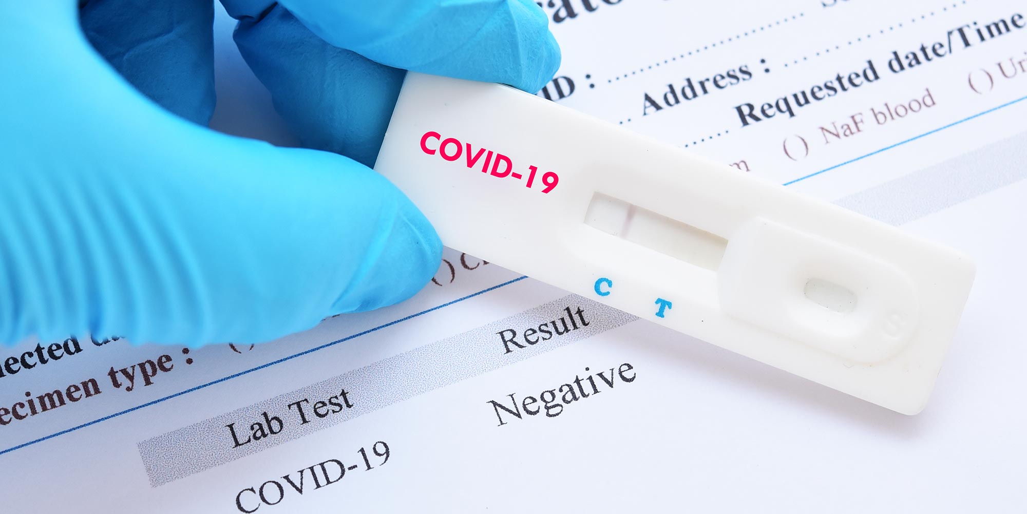 Covid 19 negative test result