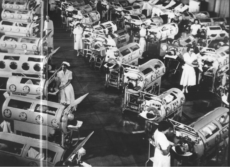 What Is an Iron Lung, and How Does It Work?