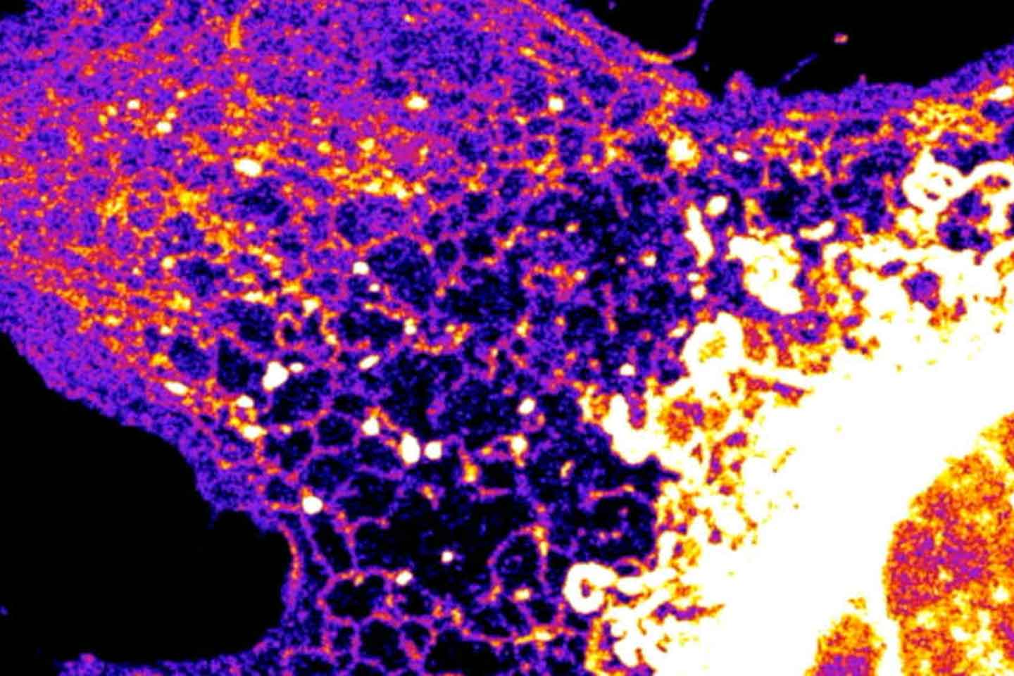 Fibroblast cells are important for healing wounds. Copyright: Leonel Malacrida, (CZI Imaging Scientist at Institut Pasteur de Montevideo-University of the Republic of Uruguay)