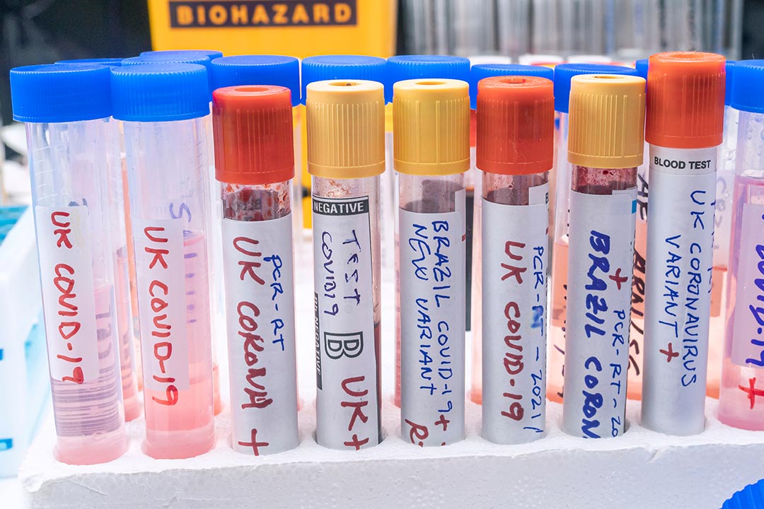 Several vials of blood samples positive for covid-19 infection of the new variant in the UK