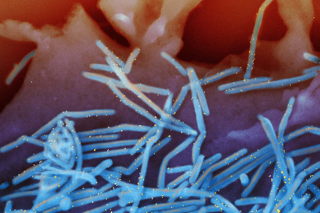 An electron micrograph of human respiratory syncytial virus (RSV) (colourised blue). Experts say RSV cases are likely to be on the rise as masks and lockdowns have led to a reduction in natural immunity. Copyright: National Institute of Allergy and Infectious Diseases, National Institutes of Health, (CC BY-NC 2.0).
