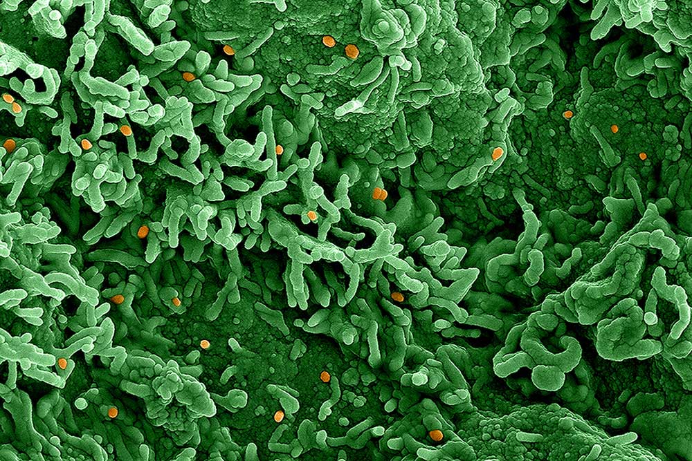 Scanning electron micrograph of monkeypox virus. Image captured at the National Institute of Allergy and Infectious Diseases Integrated Research Facility. Copyright: NIAID, CC BY 2.0