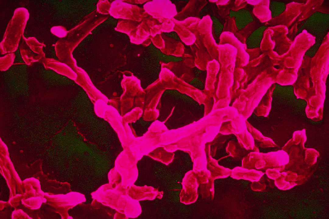 Electron microscope image of Salmonella Typhi, which causes typhoid fever. Drug-resistant typhoid is now spreading worldwide from South Asia. Copyright: Alain Grillet/Sanofi Pasteur, CC BY-NC-ND 2.0