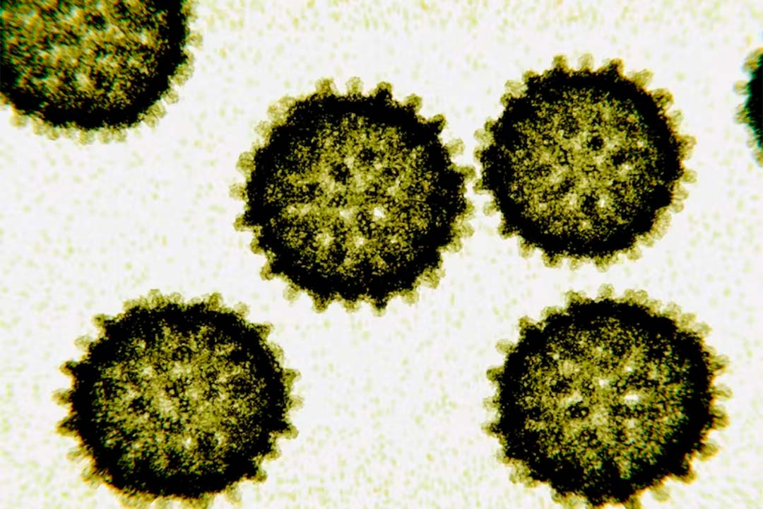 Imaging the proteins on the surface of HCV has been challenging because of the virus’s shape-shifting nature. Juan Gaertner/Science Photo Library via Getty Images