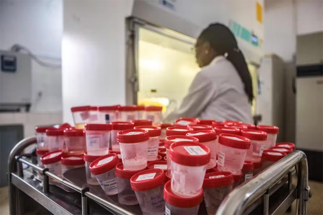 Scientist analyses flasks of saliva of TB patients. Credit: Yanick Folly/AFP via Getty Images