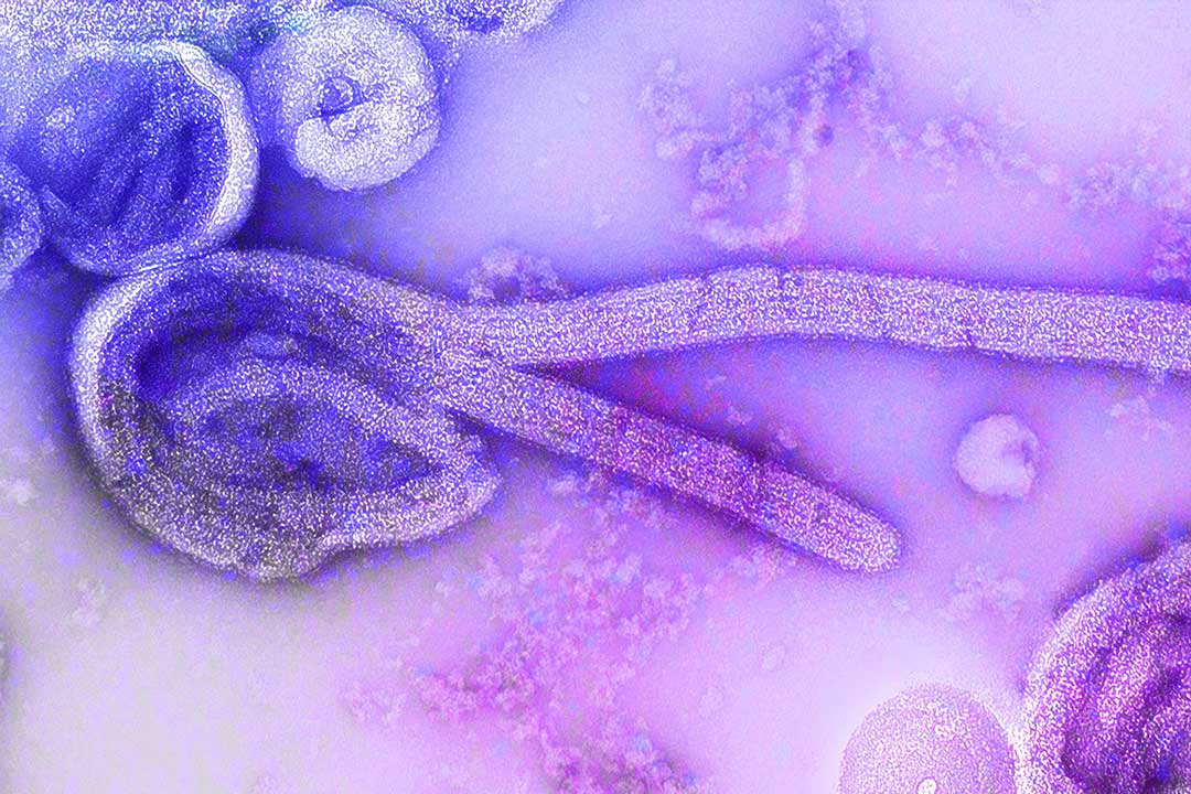 Le virus Ebola. Crédit : Photo by CDC on Unsplash