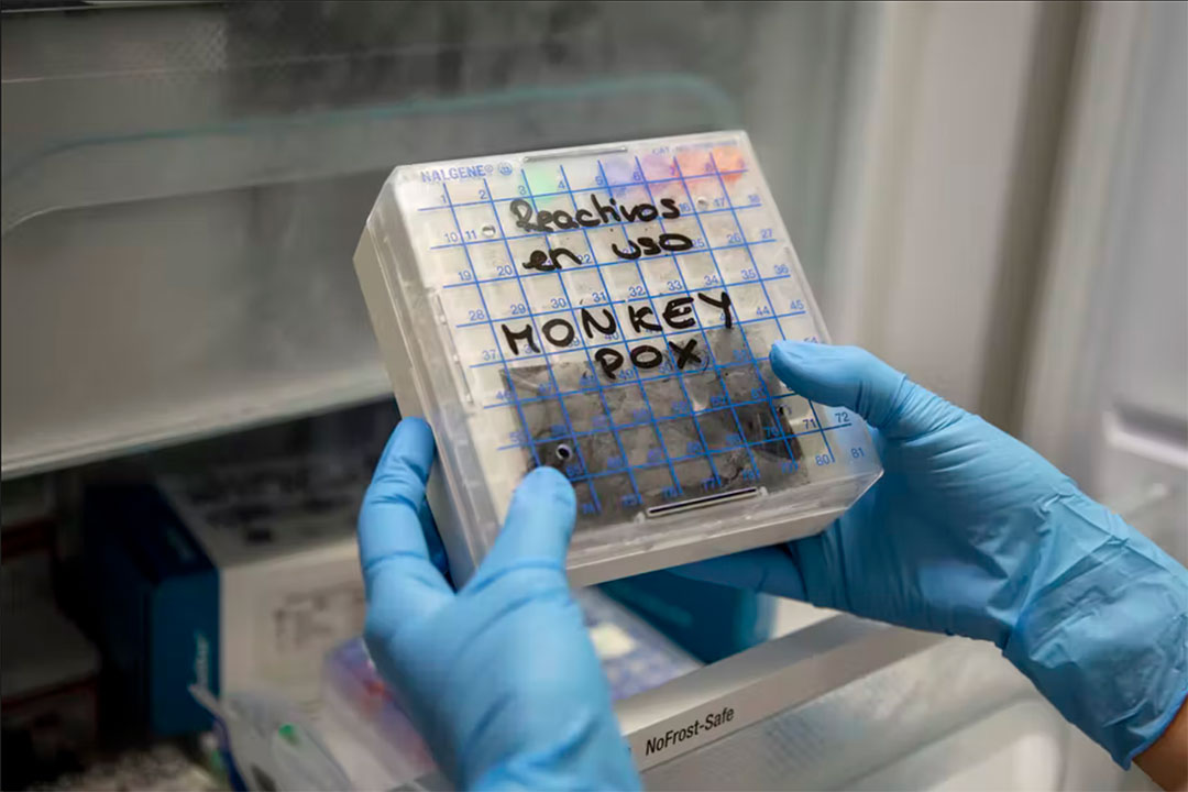 A lab technician in Spain picks up a reactive to test suspected monkeypox samples. Pablo Blazquez Dominguez/Getty Images