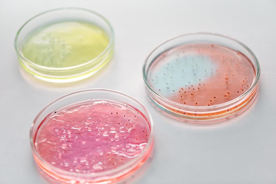 Close up of petri dishes. Credit: Edward Jenner / Pexels