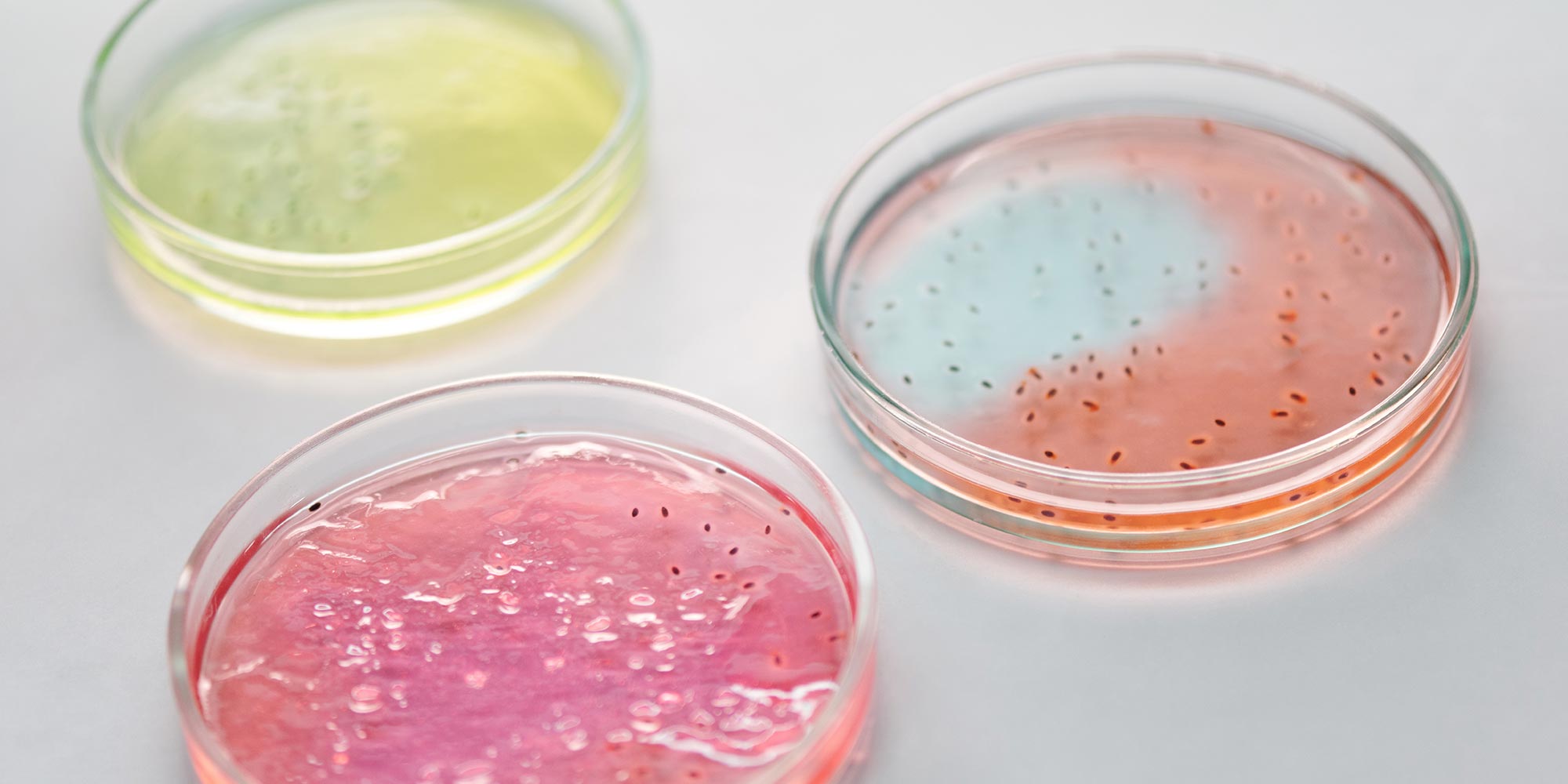 Petri dishes.